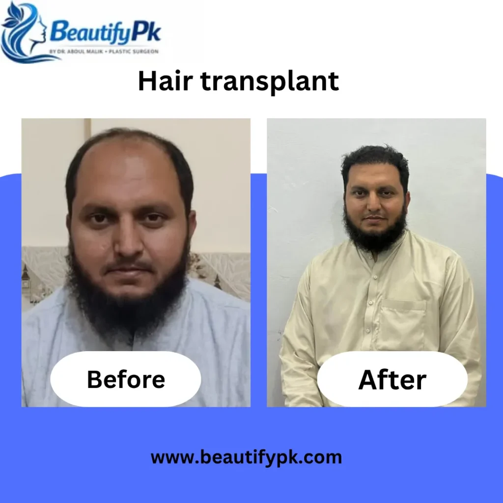 R&H Aesthetics Clinic Lahore – Dr. Abdul Malik gallery photo