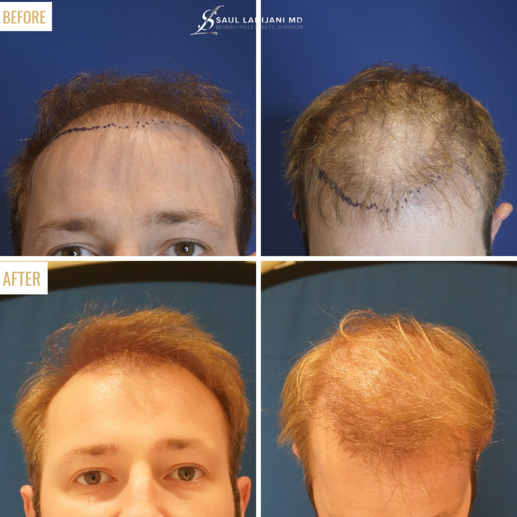 Beverly Hills Hair Center gallery photo