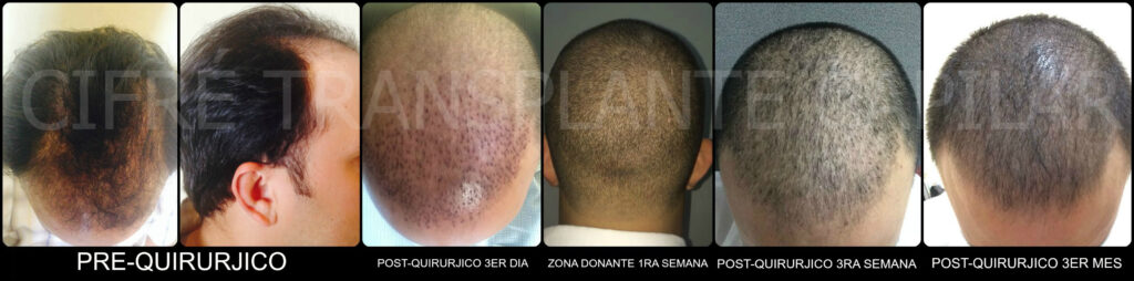 Cifre Clinica de Estetica Santo Domingo gallery photo