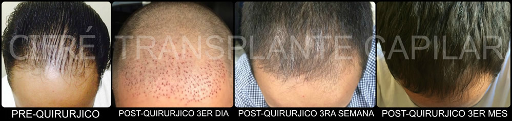Cifre Clinica de Estetica Santo Domingo gallery photo