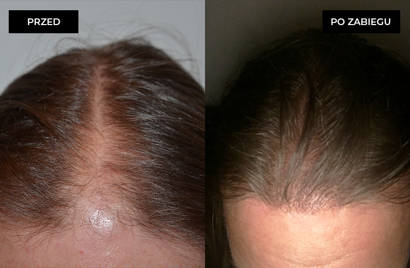 Hair transplantation clinic gallery photo