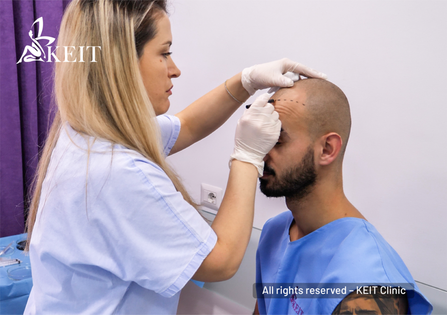 KEIT Hair Transplant gallery photo