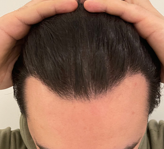 Sharley Hair Clinic — Warsaw gallery photo