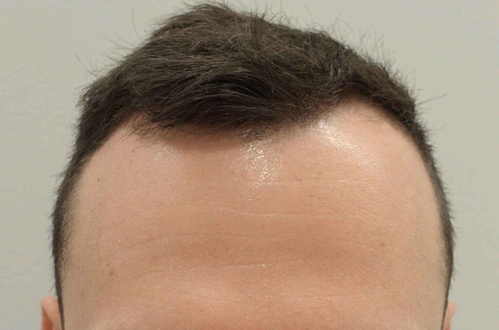 HairIn Clinic – für professionelle Haartransplantation – Est. 2010 gallery photo