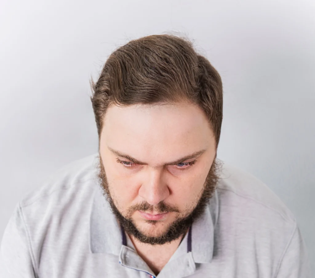Nelsus Hair Restoration Clinic gallery photo