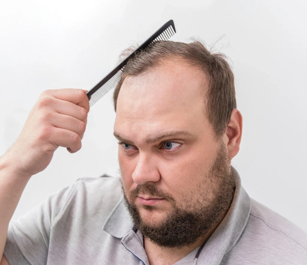 Nelsus Hair Restoration Clinic gallery photo
