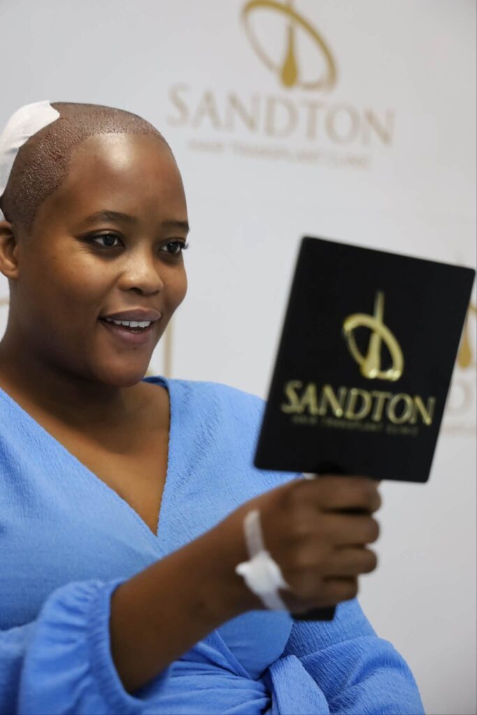 Sandton Hair Transplant Clinic gallery photo