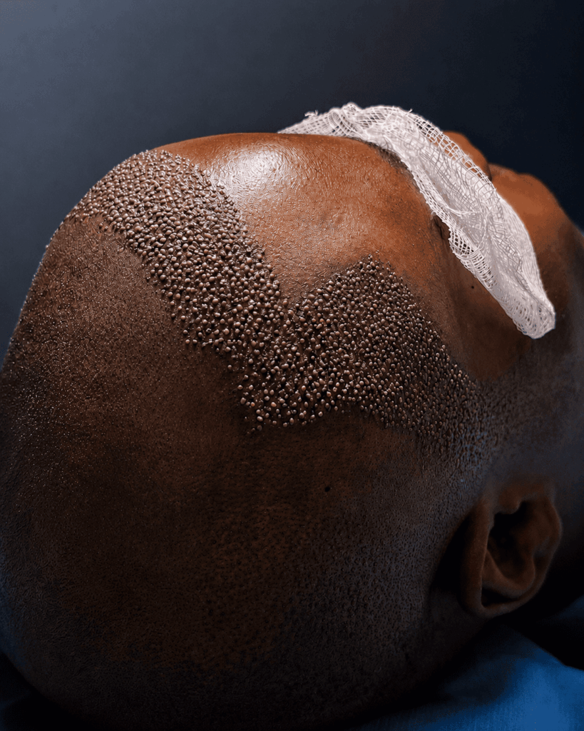 Sandton Hair Transplant Clinic gallery photo