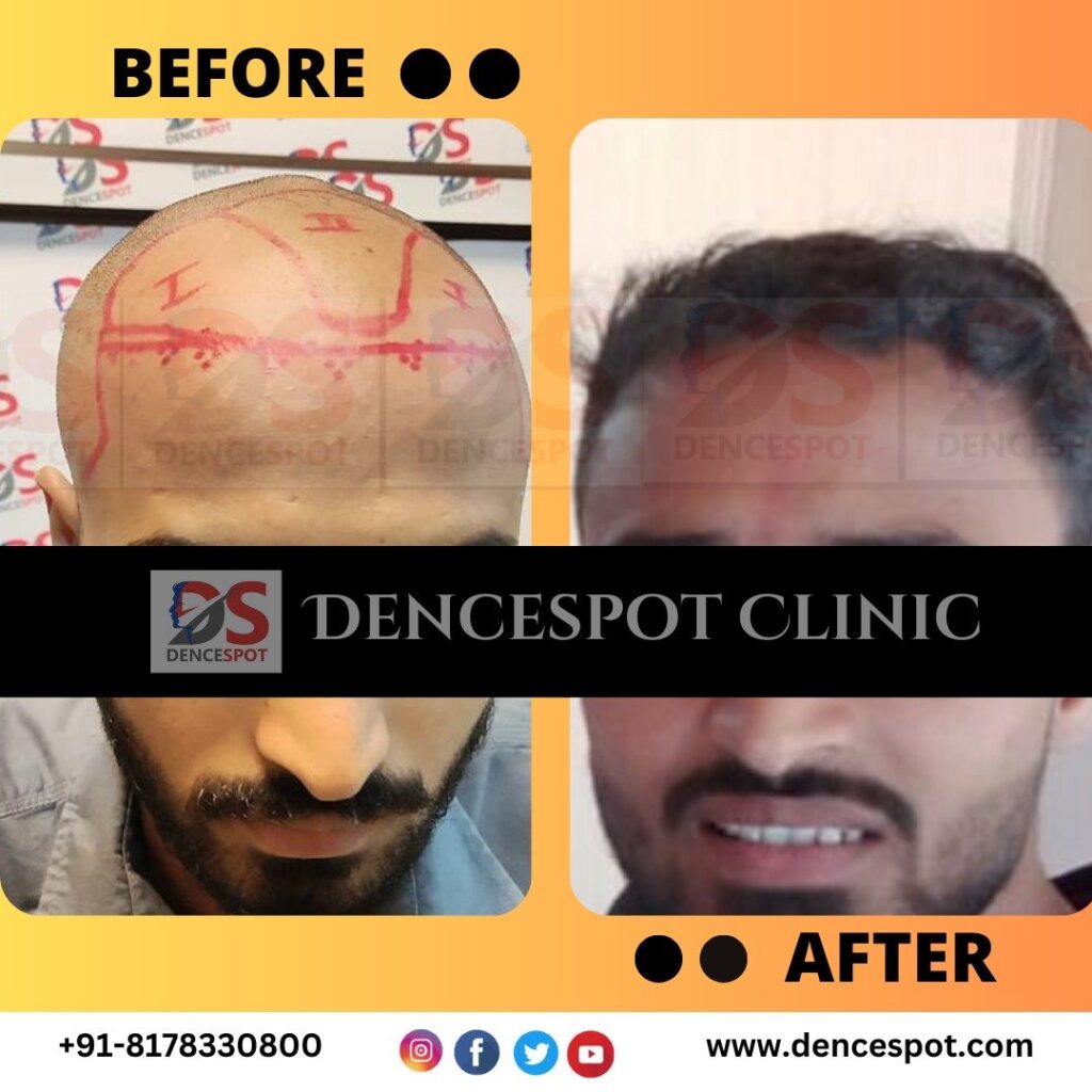 Dencespot Clinic gallery photo