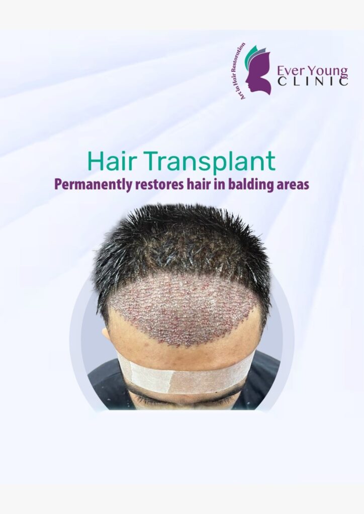 Ever Young Hair Restoration Clinic – Dr. Wajeeha gallery photo