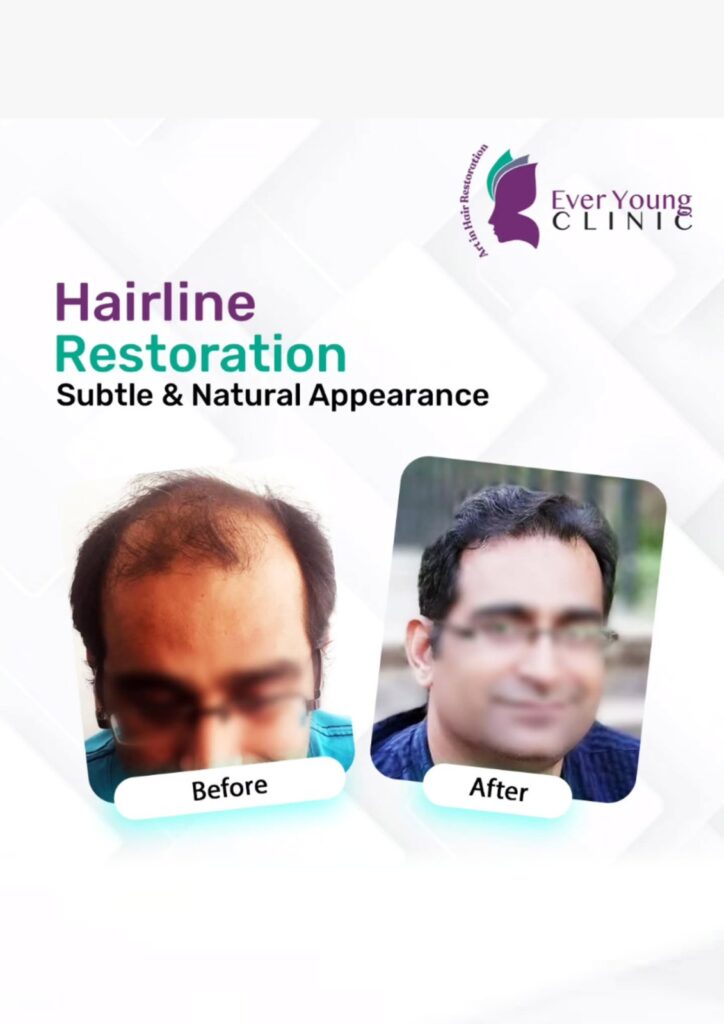 Ever Young Hair Restoration Clinic – Dr. Wajeeha gallery photo