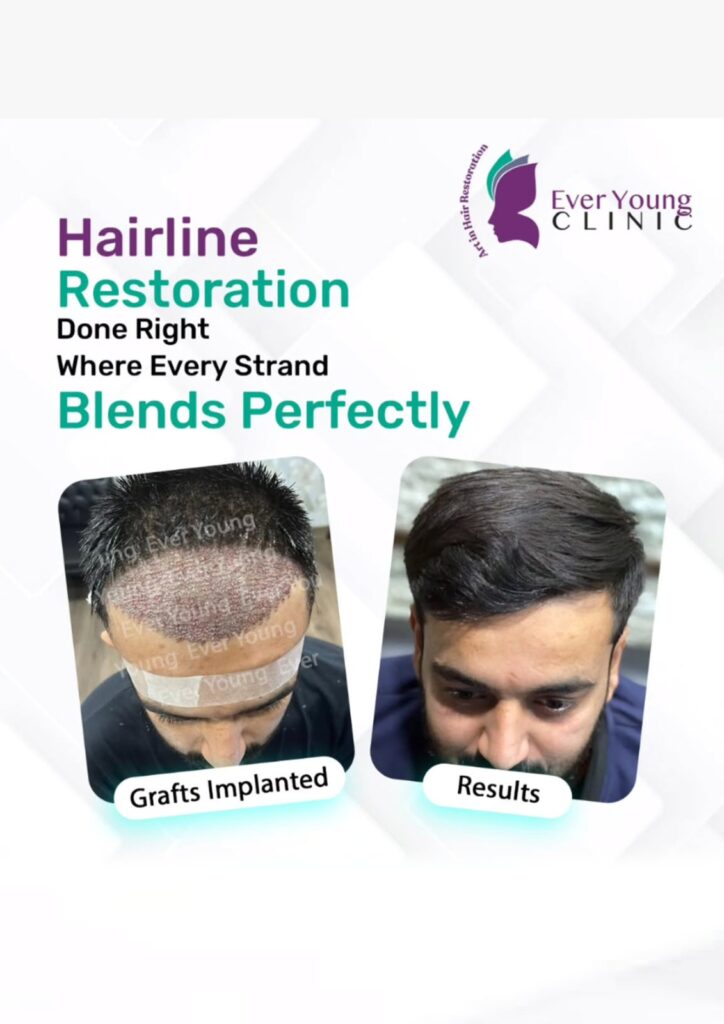 Ever Young Hair Restoration Clinic – Dr. Wajeeha gallery photo