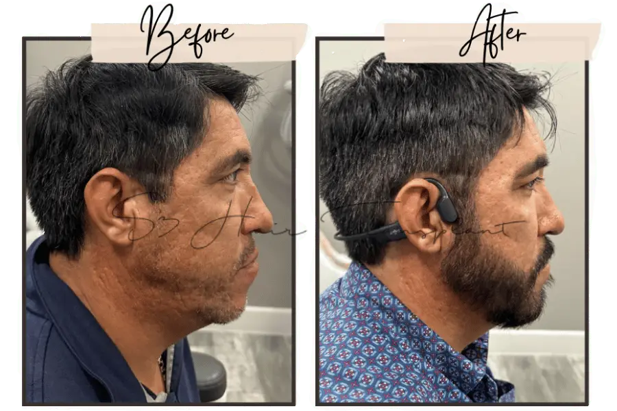 S3 Hair Transplant Clinic gallery photo