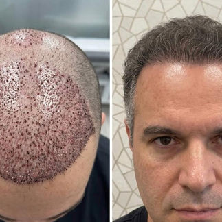 Dr Ahsen Hair Clinic Dubai gallery photo