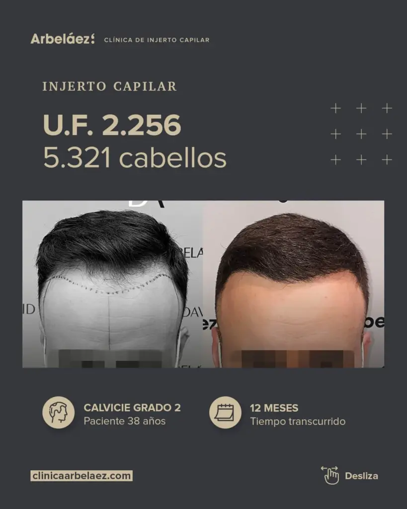 Dr. Arbeláez Clínica de Injerto y Medicina Capilar gallery photo