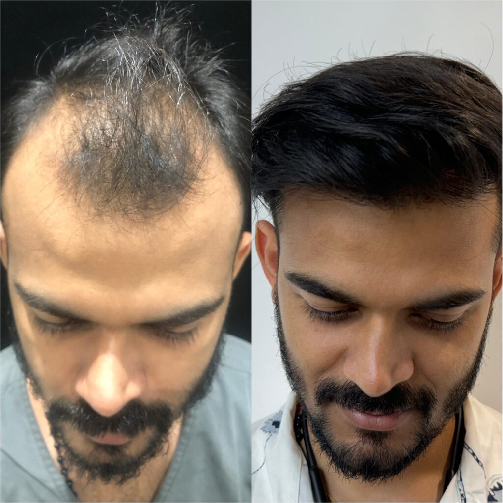 Dermaiims Hair Transplant Clinic Delhi gallery photo