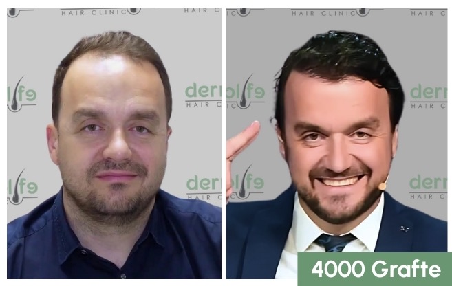 Dermolife Hair Clinic Albania gallery photo