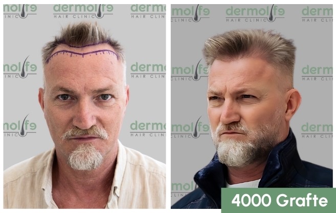Dermolife Hair Clinic Albania gallery photo