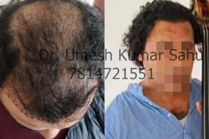 Derma Clinique Mohali gallery photo