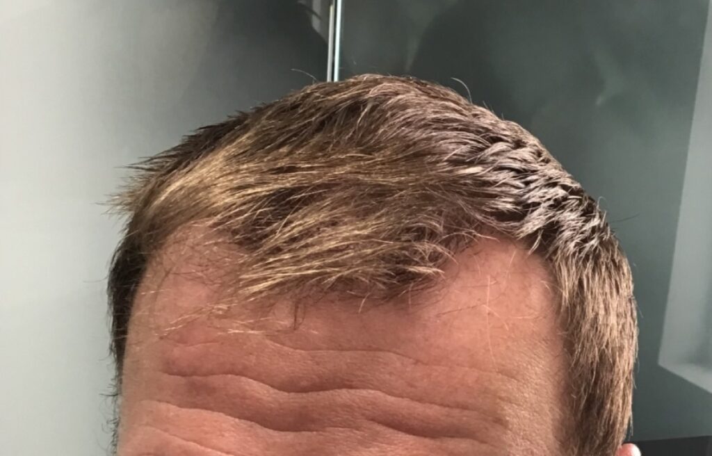 Hair Restoration & Aesthetics of Buffalo gallery photo