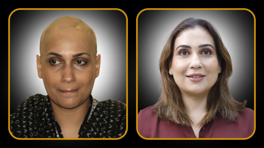 Dr Mazhar Hussain Hair Transplant Islamabad gallery photo