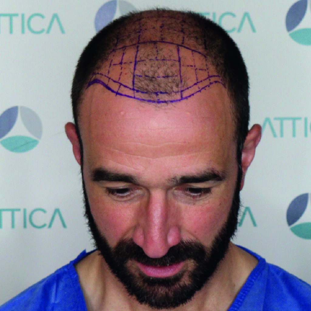 Clínica Attica – Lisboa gallery photo