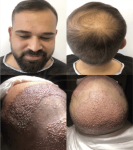 New Hair Clinic Cologne gallery photo