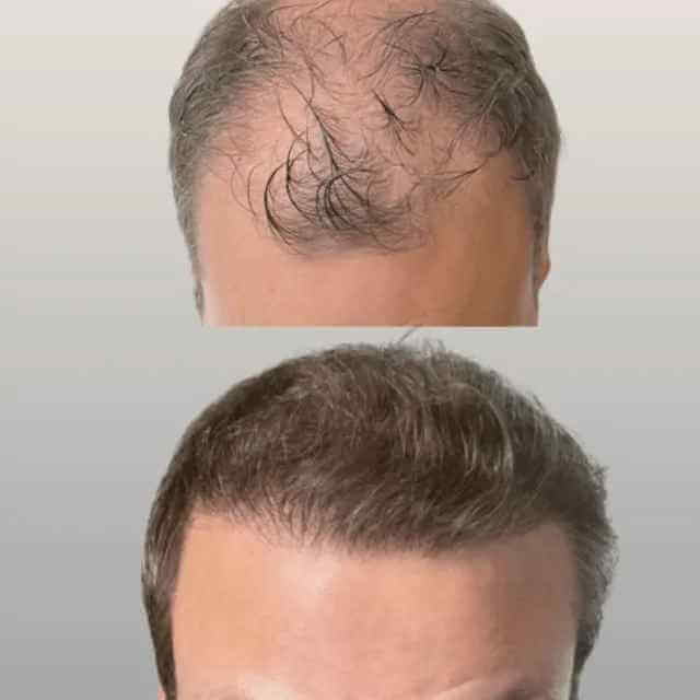 Jernigan’s Hair Replacement Clinic gallery photo