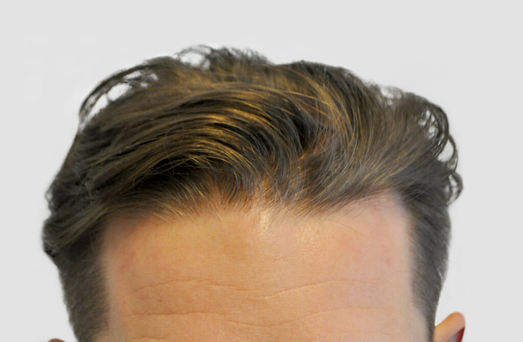 CM Hair Clinics – Medical Aesthetics gallery photo