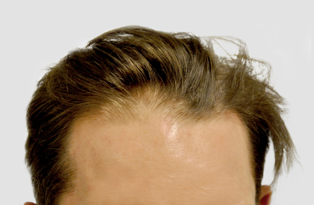 CM Hair Clinics – Medical Aesthetics gallery photo