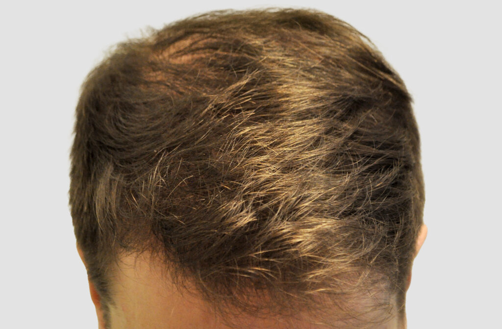 CM Hair Clinics – Medical Aesthetics gallery photo