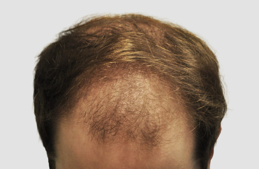 CM Hair Clinics – Medical Aesthetics gallery photo
