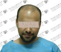Iranian Hair Transplantation and Laser Clinic Isfahan gallery photo