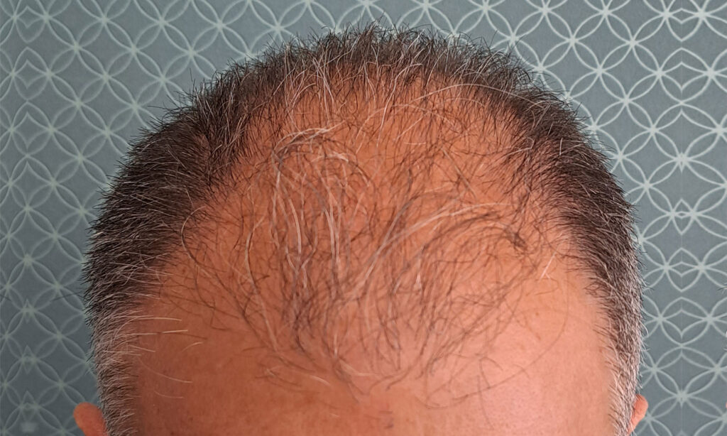 Dr Figura Medical Hair Athens gallery photo