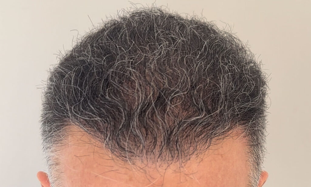 Dr Figura Medical Hair Athens gallery photo