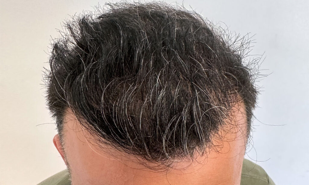 Dr Figura Medical Hair Athens gallery photo