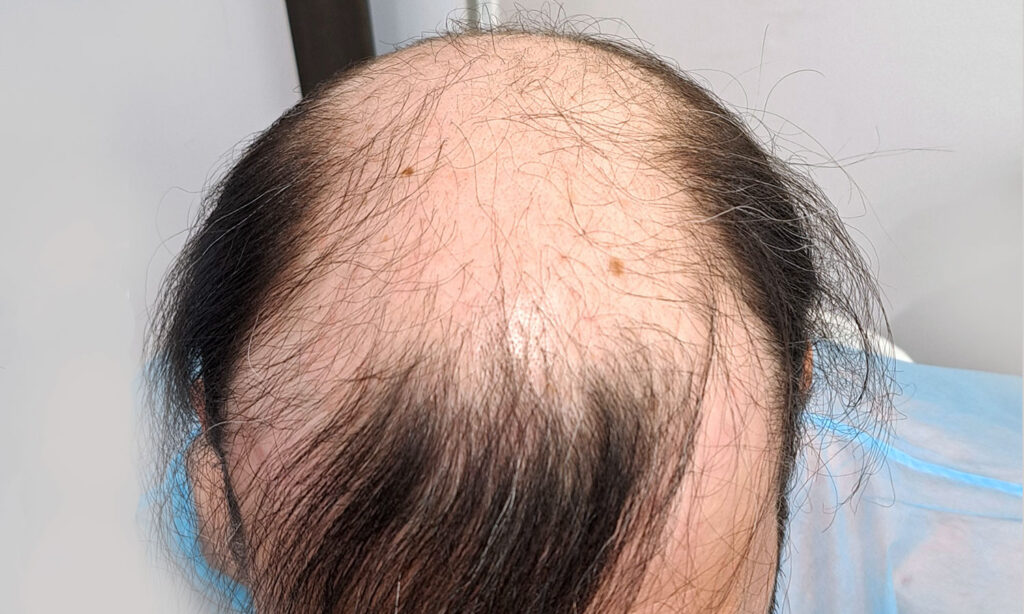 Dr Figura Medical Hair Athens gallery photo