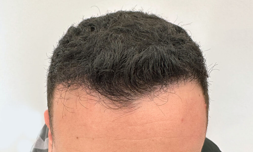 Dr Figura Medical Hair Athens gallery photo