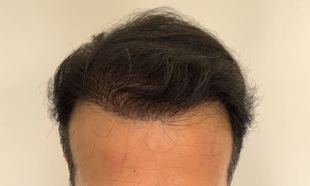 Dr Figura Medical Hair Athens gallery photo