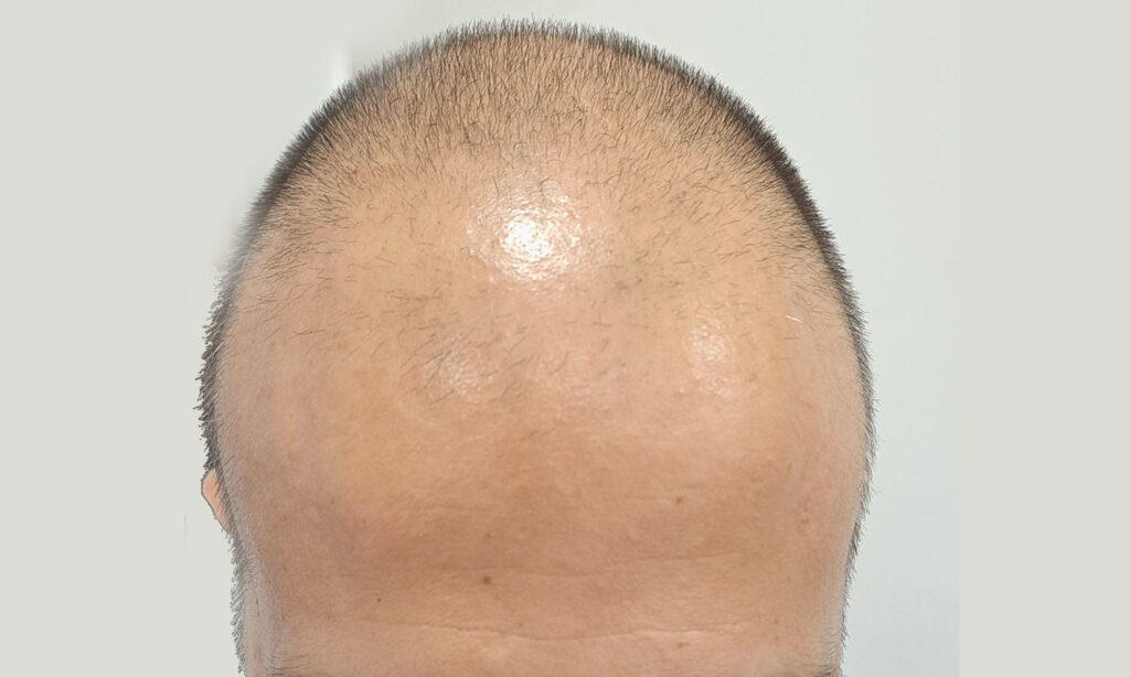 Dr Figura Medical Hair Athens gallery photo