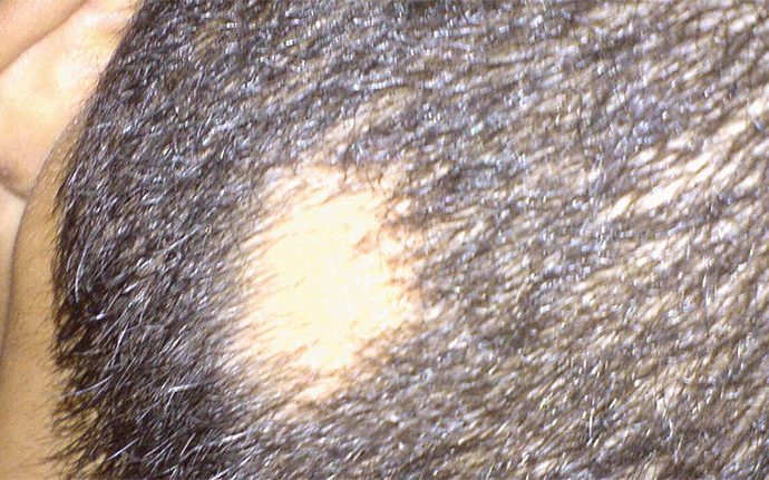 Carolina Hair Restoration Center gallery photo