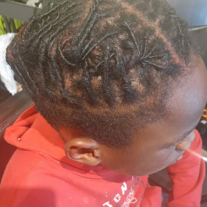 Carolina Hair Restoration Center gallery photo