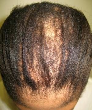 Carolina Hair Restoration Center gallery photo