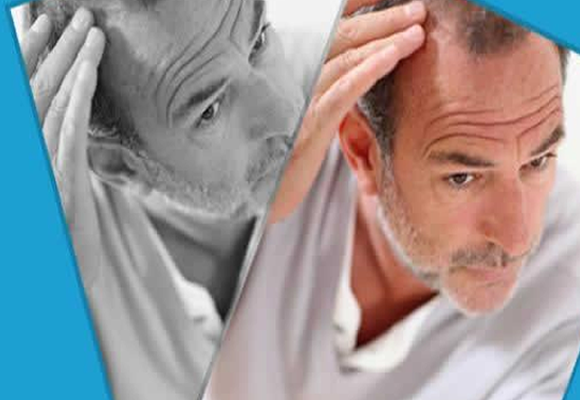 Hair Transplants of Florida gallery photo