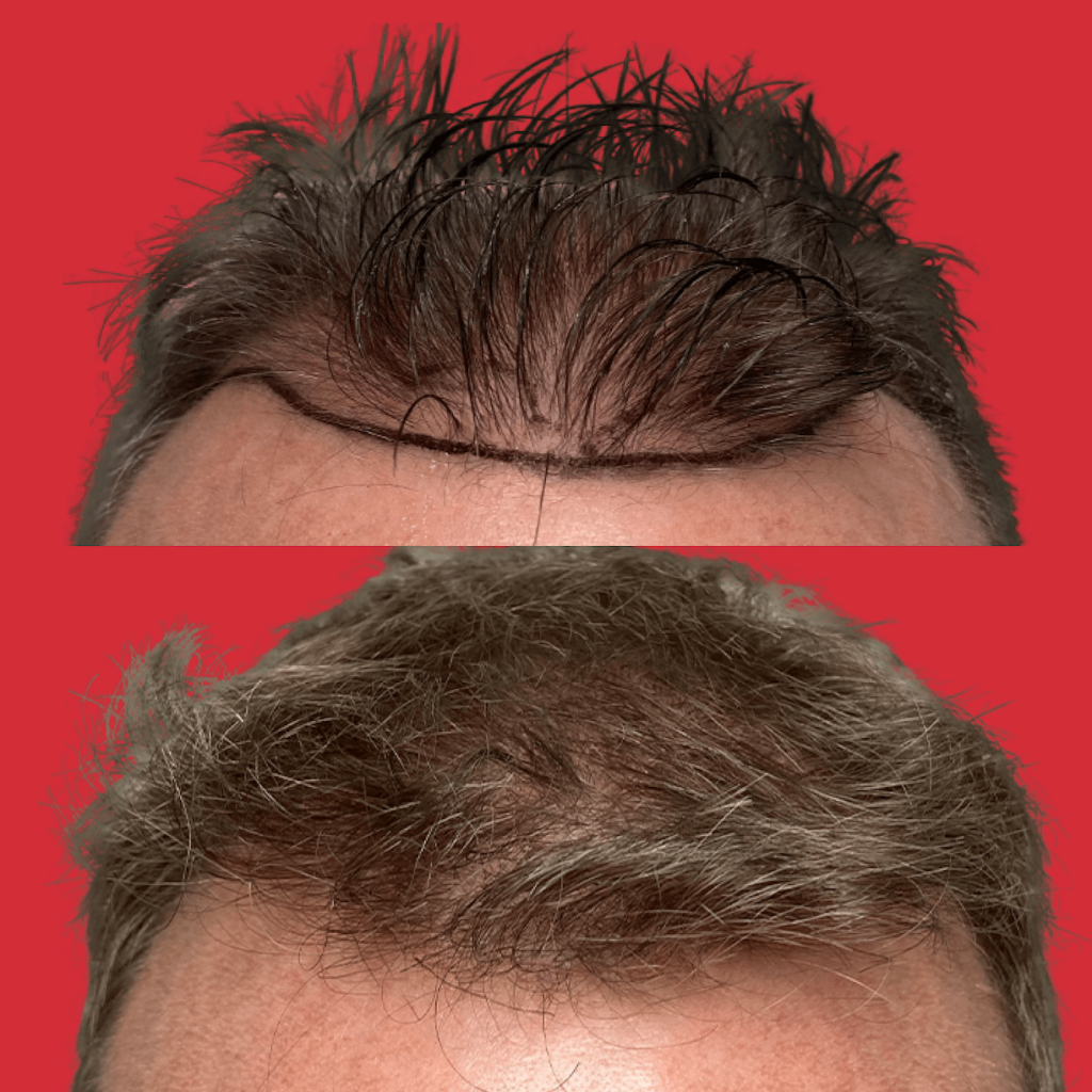 Maxim Hair Restoration & Transplants – Phoenix gallery photo