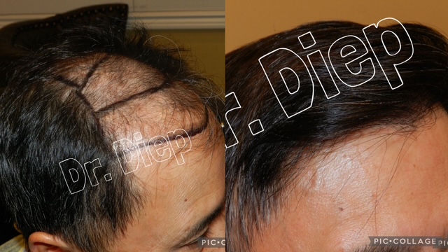 Medical Hair Transplant & Aesthetics gallery photo