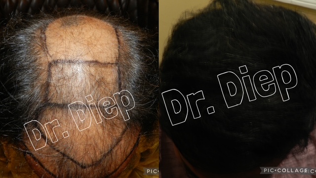 Medical Hair Transplant & Aesthetics gallery photo