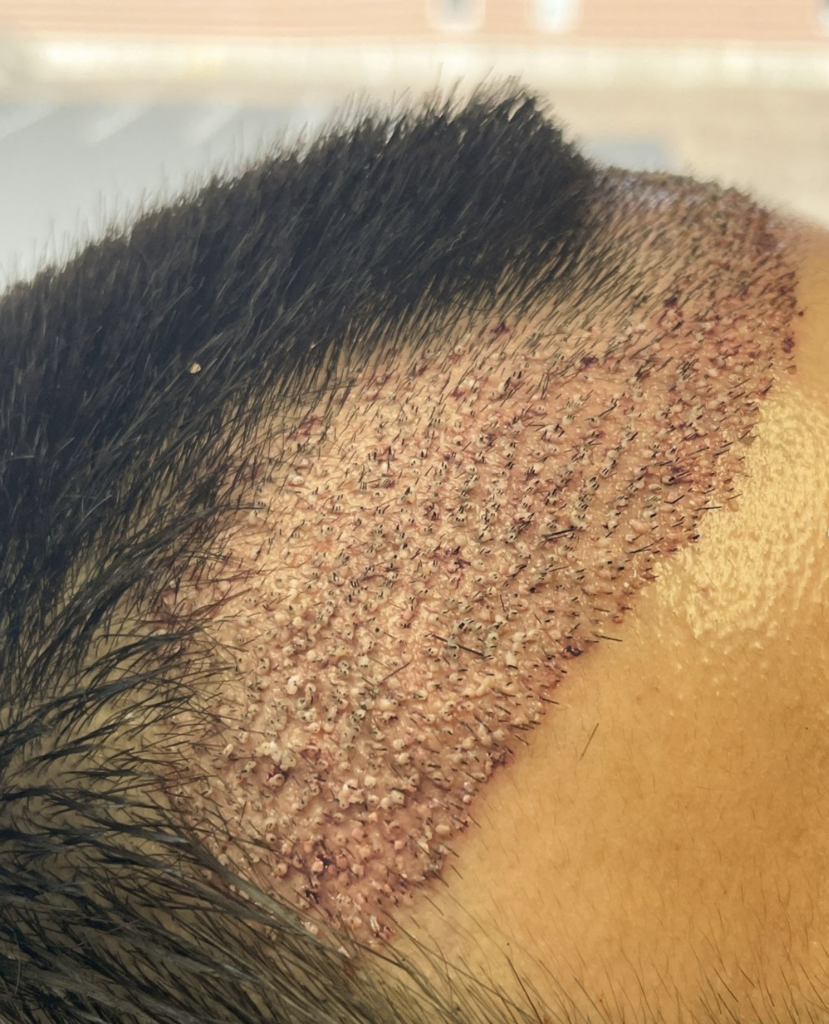 New England Center for Hair Restoration gallery photo