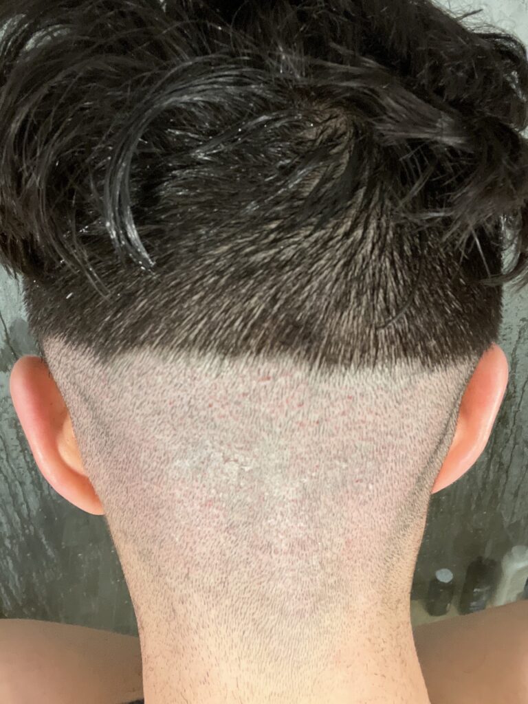 New England Center for Hair Restoration gallery photo