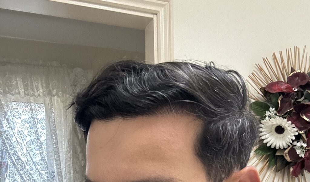 Elite Hair Clinic gallery photo